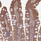 Anti-PLEKHM1 Antibody