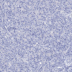 Anti-NLRP14 Antibody