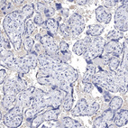 Anti-NLRP14 Antibody