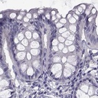 Anti-FAM71B Antibody