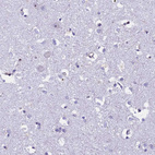 Anti-EHBP1L1 Antibody