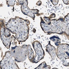 Anti-STARD13 Antibody