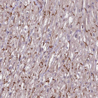 Immunohistochemical staining of human heart muscle shows moderate cytoplasmic positivity in cardiomyocytes.