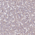 Immunohistochemical staining of human liver shows very weak membranous positivity in hepatocytes.