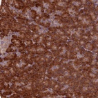 Anti-TBC1D19 Antibody