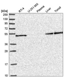 Anti-SLC25A46 Antibody