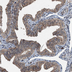 Anti-TCTN1 Antibody