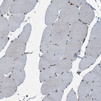 Immunohistochemical staining of human skeletal muscle shows no cytoplasmic positivity in myocytes as expected.