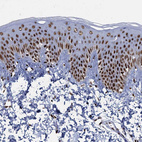 Anti-RPUSD4 Antibody