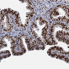 Anti-RPUSD4 Antibody