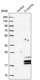 Anti-C12orf76 Antibody