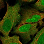 Anti-PYM1 Antibody