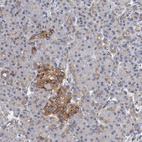 Anti-NBEA Antibody