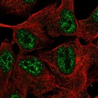 Anti-TMEM101 Antibody