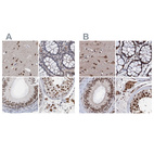 Anti-CSTF3 Antibody