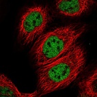 Anti-CSTF3 Antibody