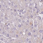 Anti-NXPE2 Antibody