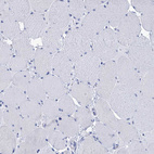 Anti-RAB3IP Antibody