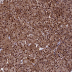 Anti-C14orf166 Antibody