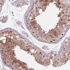 Anti-CCNI Antibody