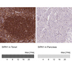 Anti-SIPA1 Antibody