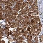 Anti-C11orf57 Antibody