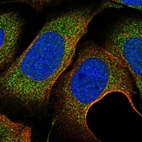 Anti-C11orf57 Antibody