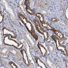 Anti-TMEM72 Antibody