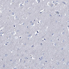 Anti-TMEM72 Antibody