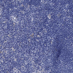 Anti-TMEM72 Antibody