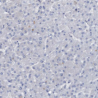 Anti-TMEM72 Antibody