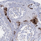 Anti-TRIM77 Antibody