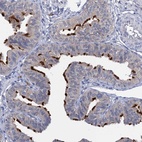 Anti-ANKRD42 Antibody