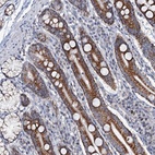 Anti-MRPL51 Antibody