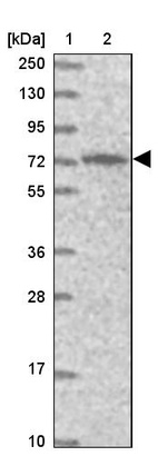 Anti-PIGB Antibody