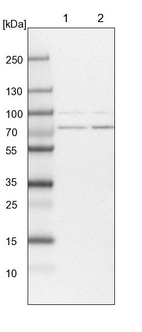 Anti-PIGB Antibody