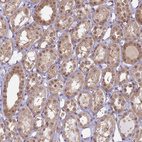 Anti-WDR61 Antibody