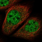 Immunofluorescent staining of human cell line A-431 shows localization to nucleoplasm.