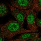 Anti-PAAF1 Antibody