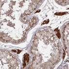 Anti-CCS Antibody