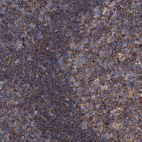 Anti-MS4A4E Antibody