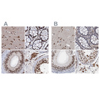 Anti-CSTF3 Antibody