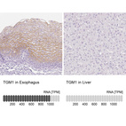 Anti-TGM1 Antibody