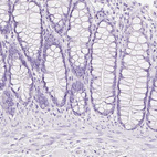 Anti-TGM1 Antibody