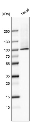 Anti-TGM1 Antibody