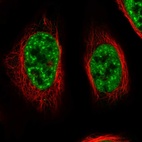 Anti-RBM26 Antibody