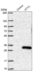 Anti-STYX Antibody