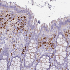 Immunohistochemical staining of human rectum shows strong cytoplasmic positivity in lymphoid cells.