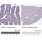 Anti-SPEF2 Antibody