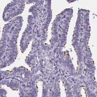 Immunohistochemical staining of human fallopian tube shows strong cytoplasmic positivity in cilia glandular cells.